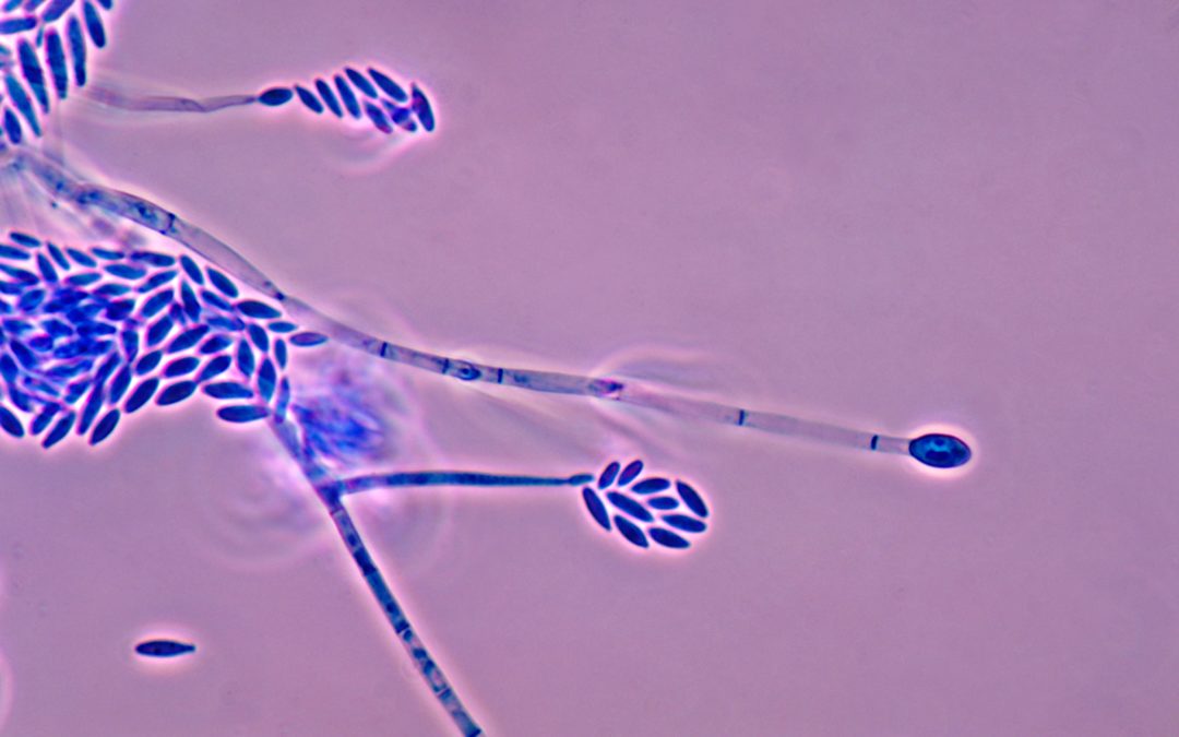 SUPERA - Hongo del género Fusarium, uno de los patógenos de plantas que se investigará en el Proyecto SUPERA
