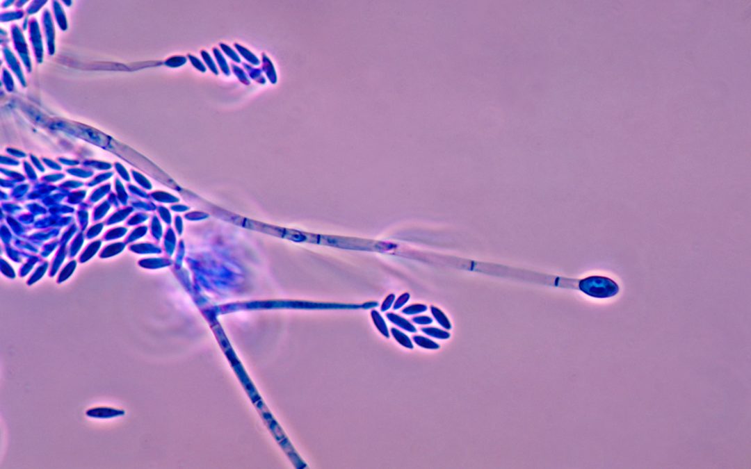 SUPERA - Hongo del género Fusarium, uno de los patógenos de plantas que se investigará en el Proyecto SUPERA